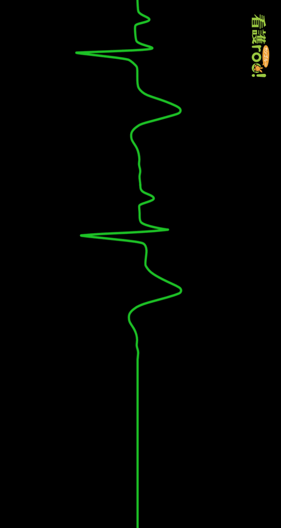 洞停止の波形の例