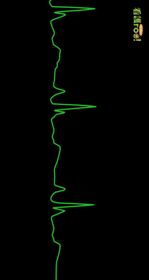 洞房ブロックの波形の例
