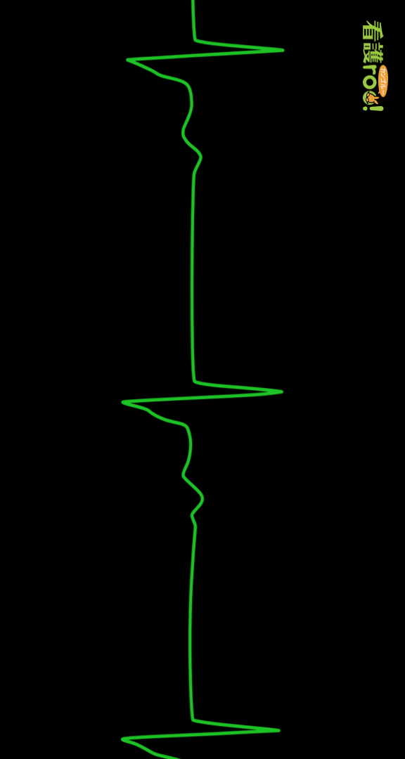 ジャンクショナルリズムの波形の例