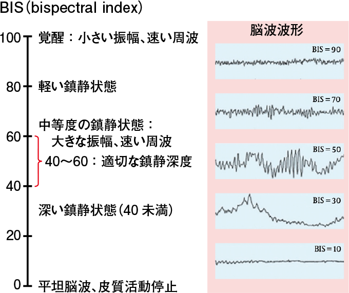 BIS(bispectral index)