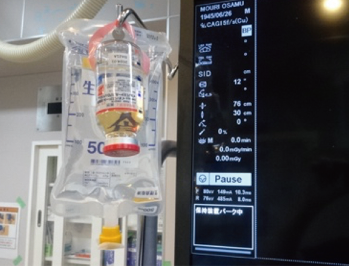 PCIにおける造影剤の準備