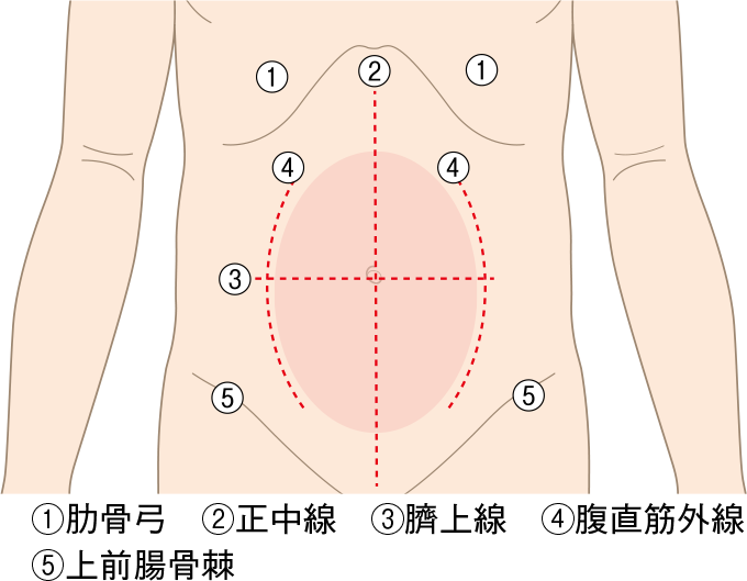 ストーマサイトマーキングでの記入線