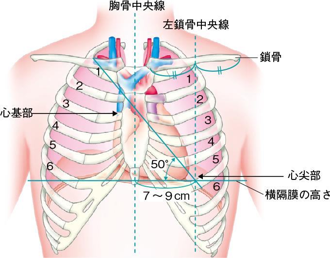 画像診断｜ICU看護実践マニュアル | 看護roo![カンゴルー]