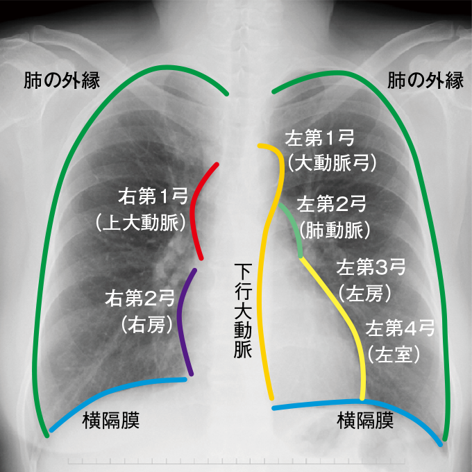 肺末梢構造にせまる胸部画像診断 胸部X線検診 肺末梢構造にせまる胸部画像診断 ｜ よくあるご質問｜まし