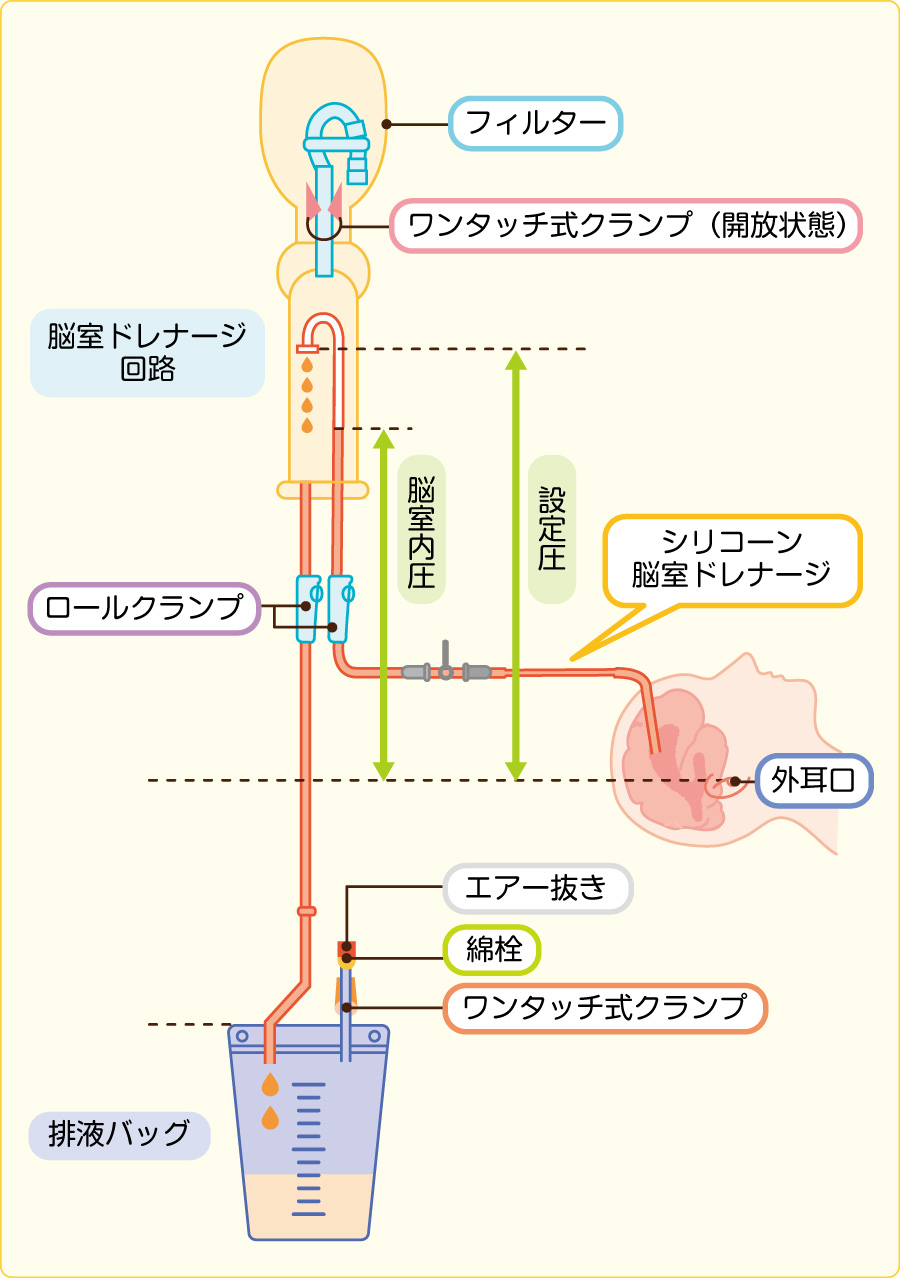 がん末期に現れる「悪液質」実はよくわかっていな …