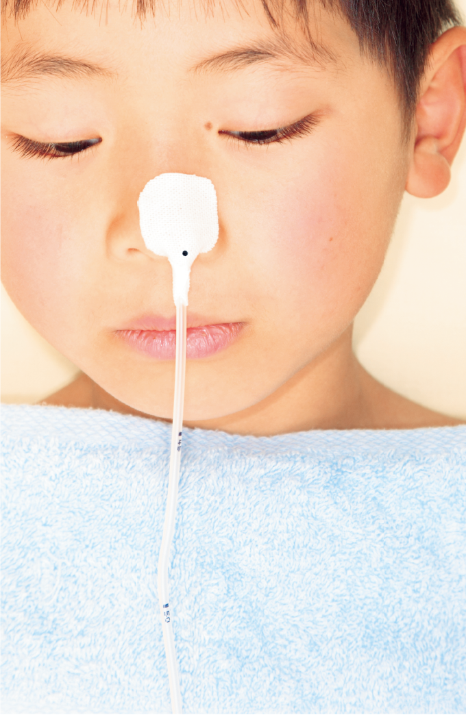 固定用テープの上から鼻孔の位置にマーキングを行う