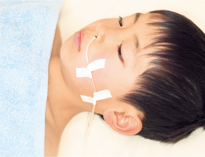 鼻孔の位置でチューブにマーキングを行う