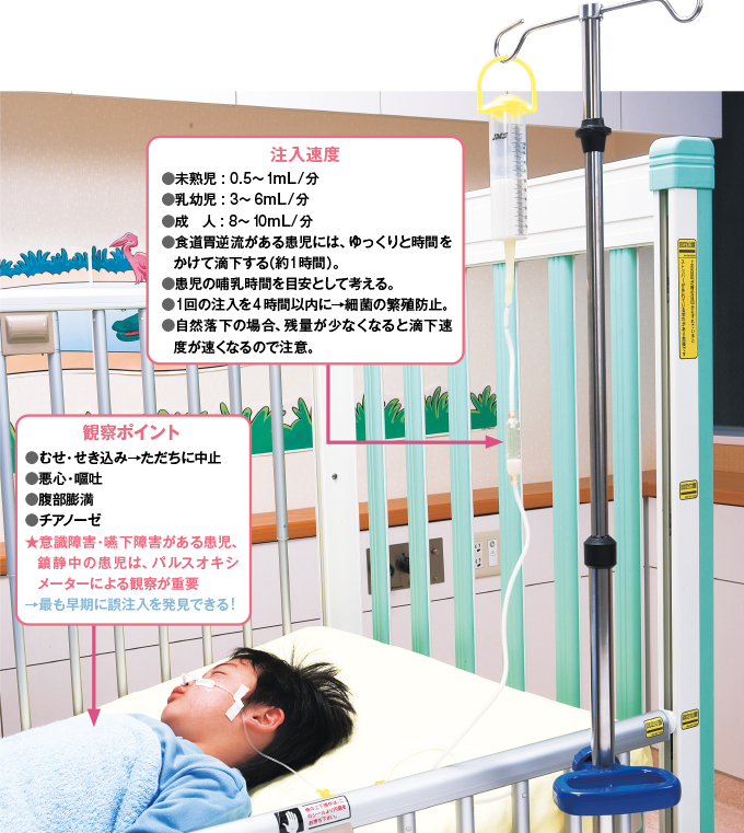 注入速度と観察ポイント