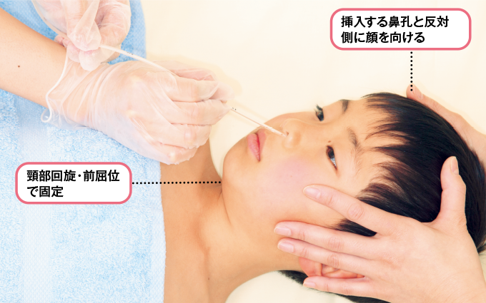 チューブを挿入する鼻孔と反対側に顔を向け、頸部前屈で頭部を固定