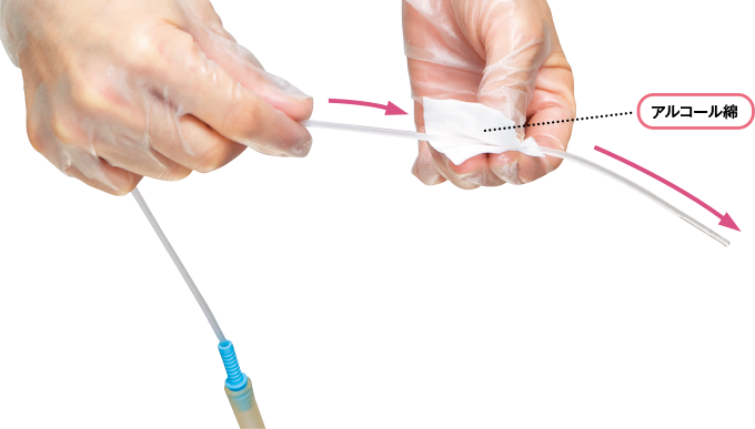 アルコール綿でカテーテル表面を拭く
