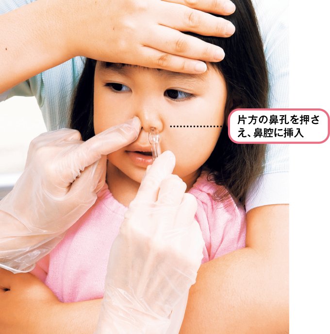 鼻腔管を鼻腔に挿入する