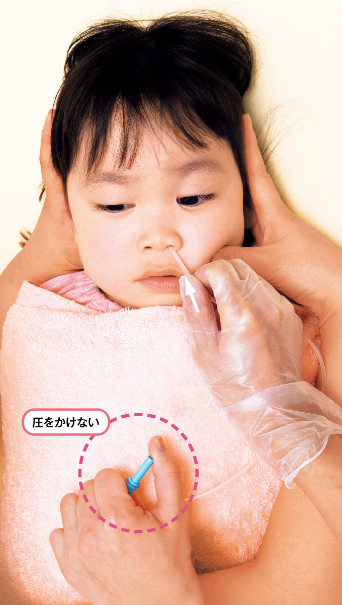 吸引カテーテルを圧をかけずに鼻腔に挿入する