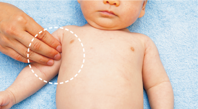 上腕動脈の場合