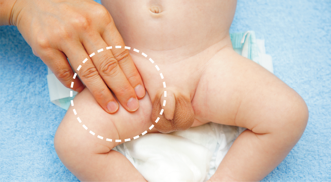 大腿動脈の場合