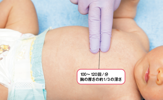 乳児の胸骨圧迫を1人で行う場合