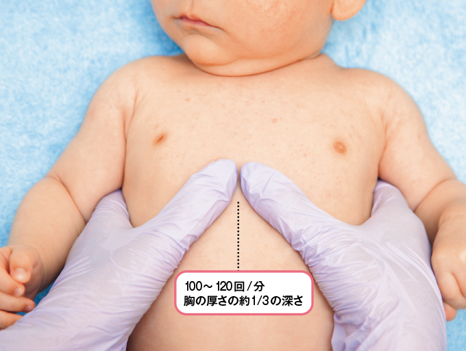 乳児の胸骨圧迫を2人で行う場合