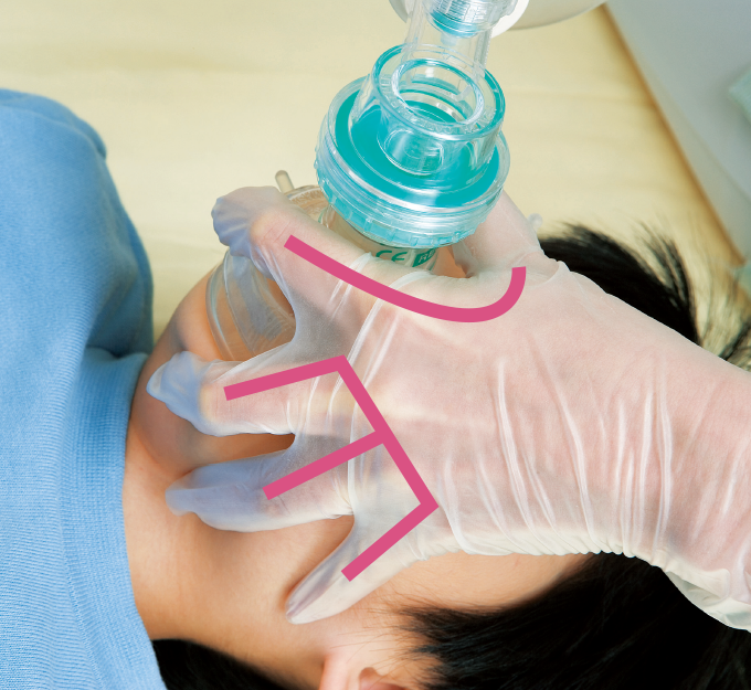 バッグバルブマスク法