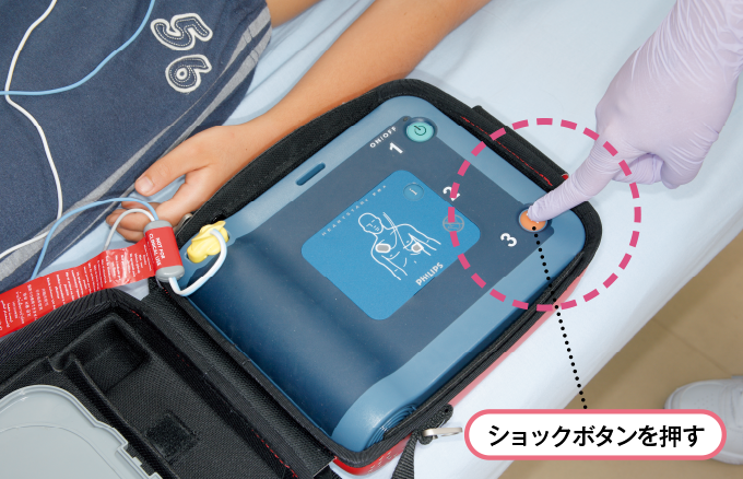 ショックボタンを押す