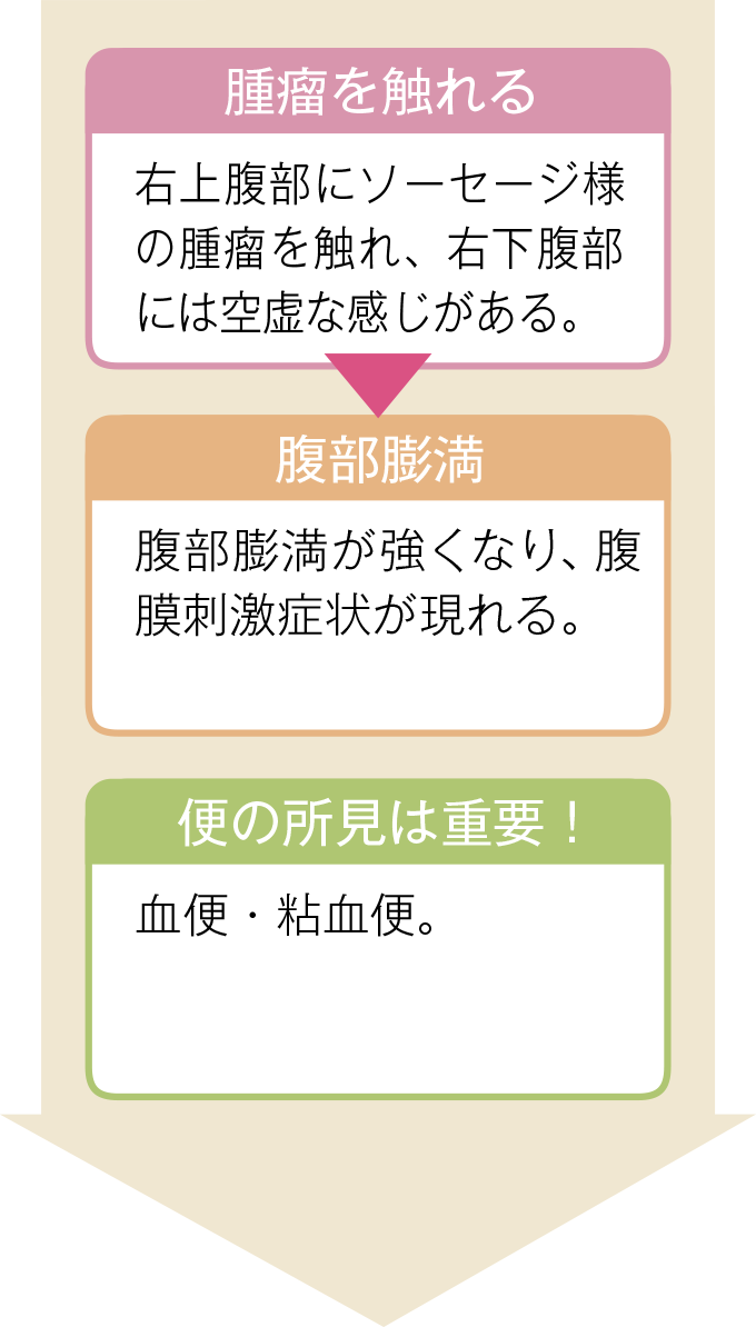 腸重積の身体所見