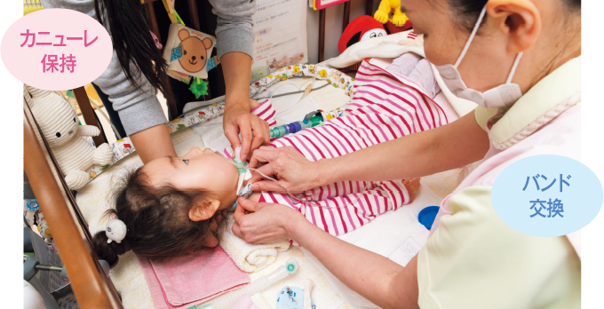カニューレバンドの交換