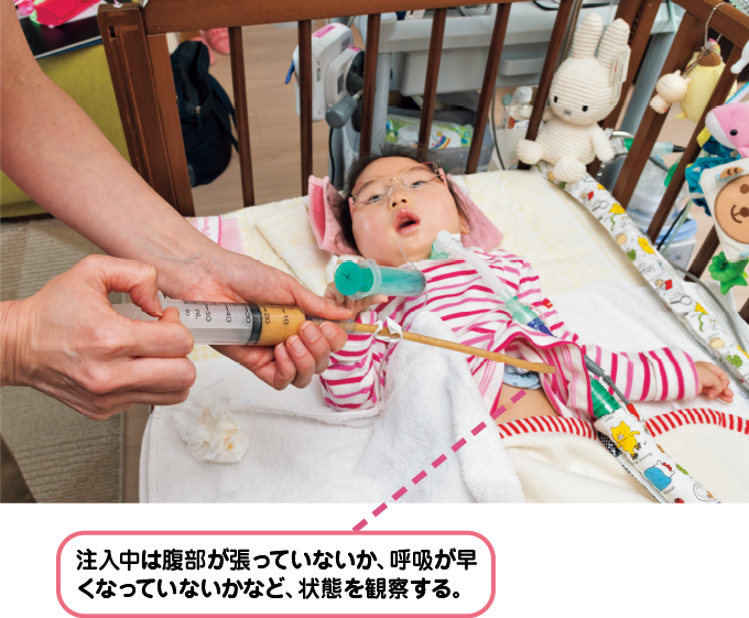 注入中は状態を観察する