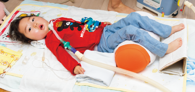 姿勢保持と理学療法