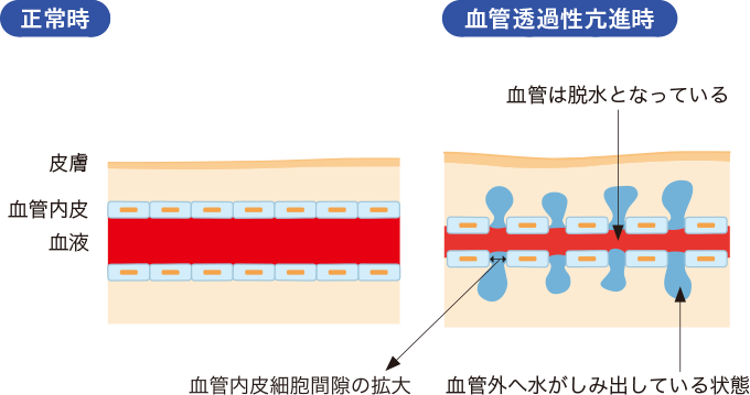 血管透過性の亢進