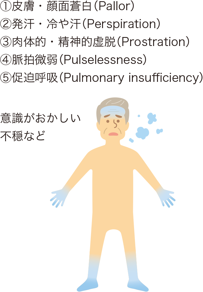 ショックの5Pを表した図