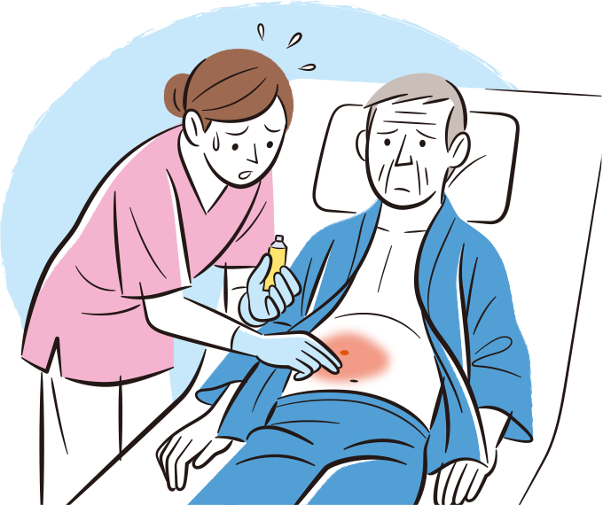 患者の創部にステロイド軟膏を塗布していたが、創部が悪化し、培養検査をしたら真菌が検出され看護師が焦っているイラスト