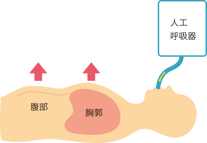 換気時の胸郭挙上を表した図