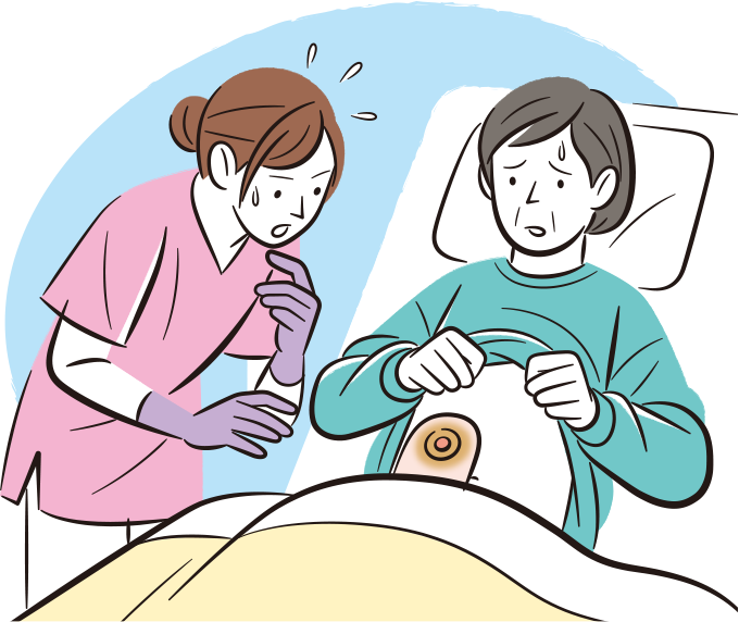 患者のストーマ装具を交換したばかりなのに、漏れが発生していて焦っている看護師のイラスト