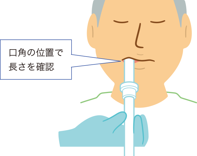気管挿管チューブの長さの確認を表した図