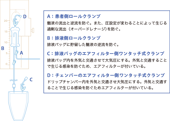 脳室ドレーンの４つのクランプの役割を表した図