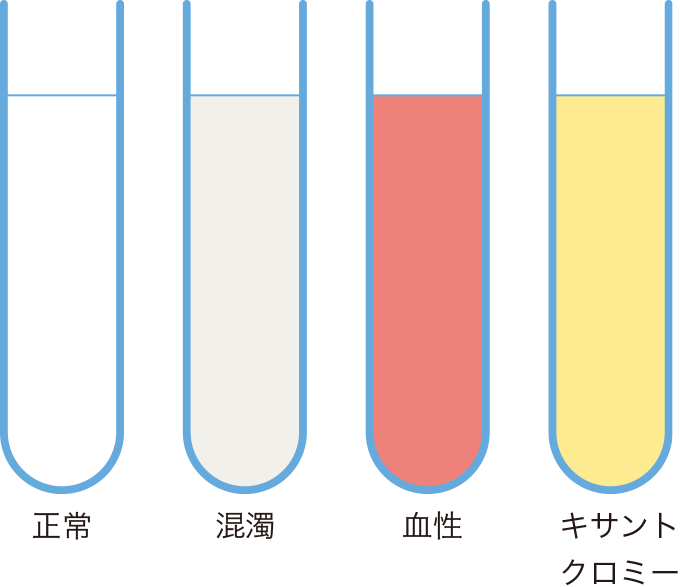 髄液の変化を表した図