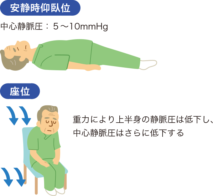 仰臥位から座位への変化を表した図