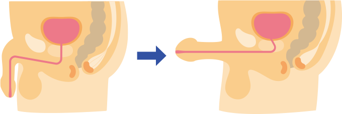 男性の尿道（矢状面）を表した図