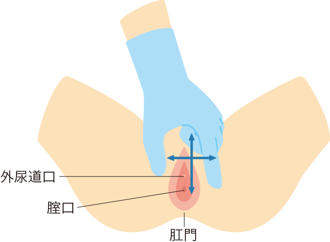 フロッグポジションをとり、陰唇を動かして尿道口を探す方法を表した図