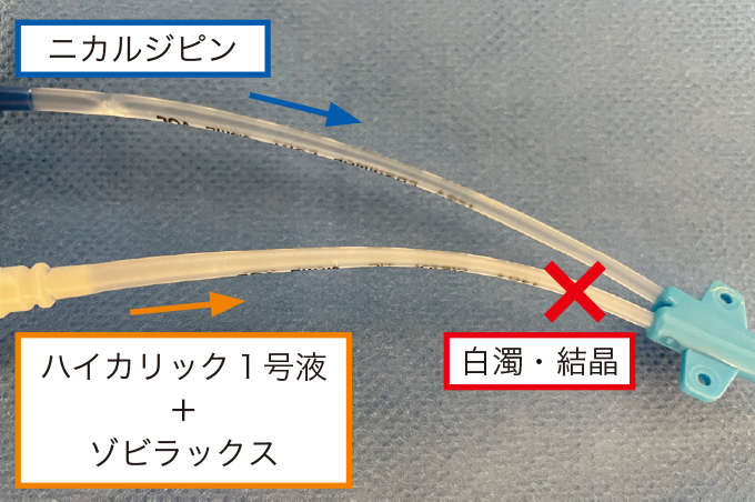 混濁した中心静脈カテーテルを示した写真