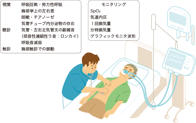 呼吸状態の観察を表した図