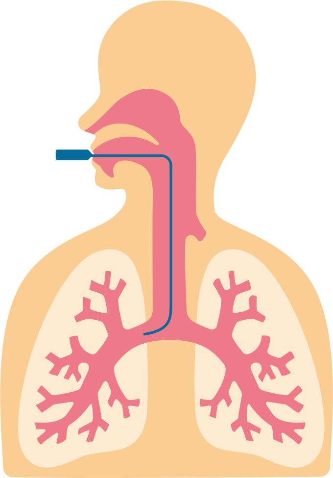 気管支鏡を表したイラスト