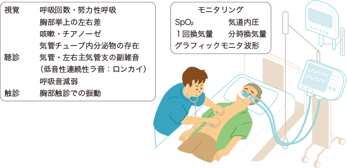 呼吸の観察を表した図
