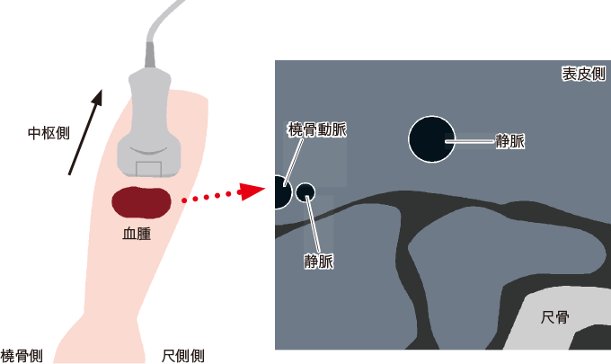 エコーで映し出されるイメージを表す図