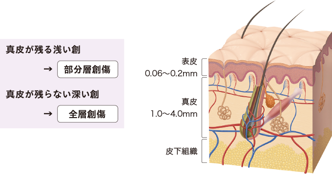皮膚の構造をあらわした図