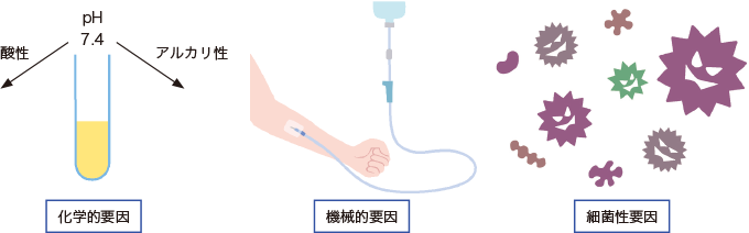 静脈炎の3つの要因をあらわす図