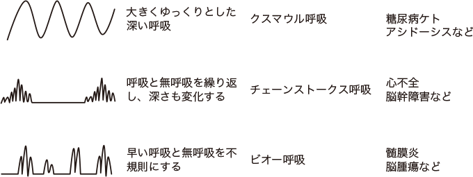 呼吸リズムの変動をあらわした図