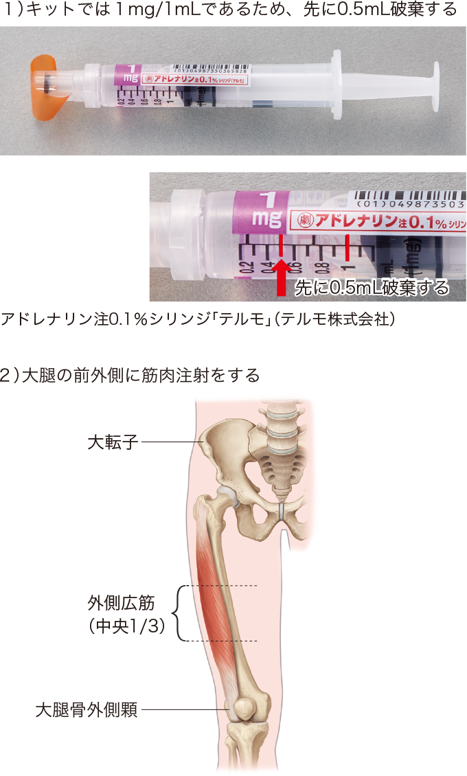 アドレナリンキットを使用する場合(0.5mg投与指示の場合)を表した写真と図