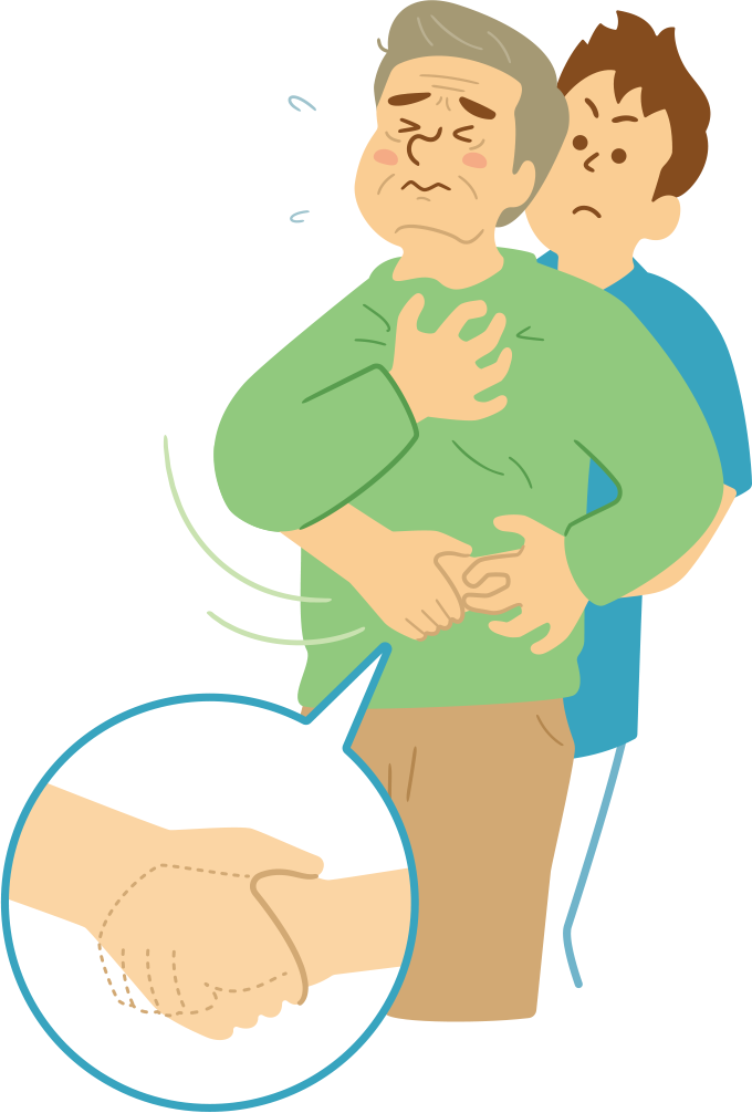 腹部突き上げ法を表したイラスト