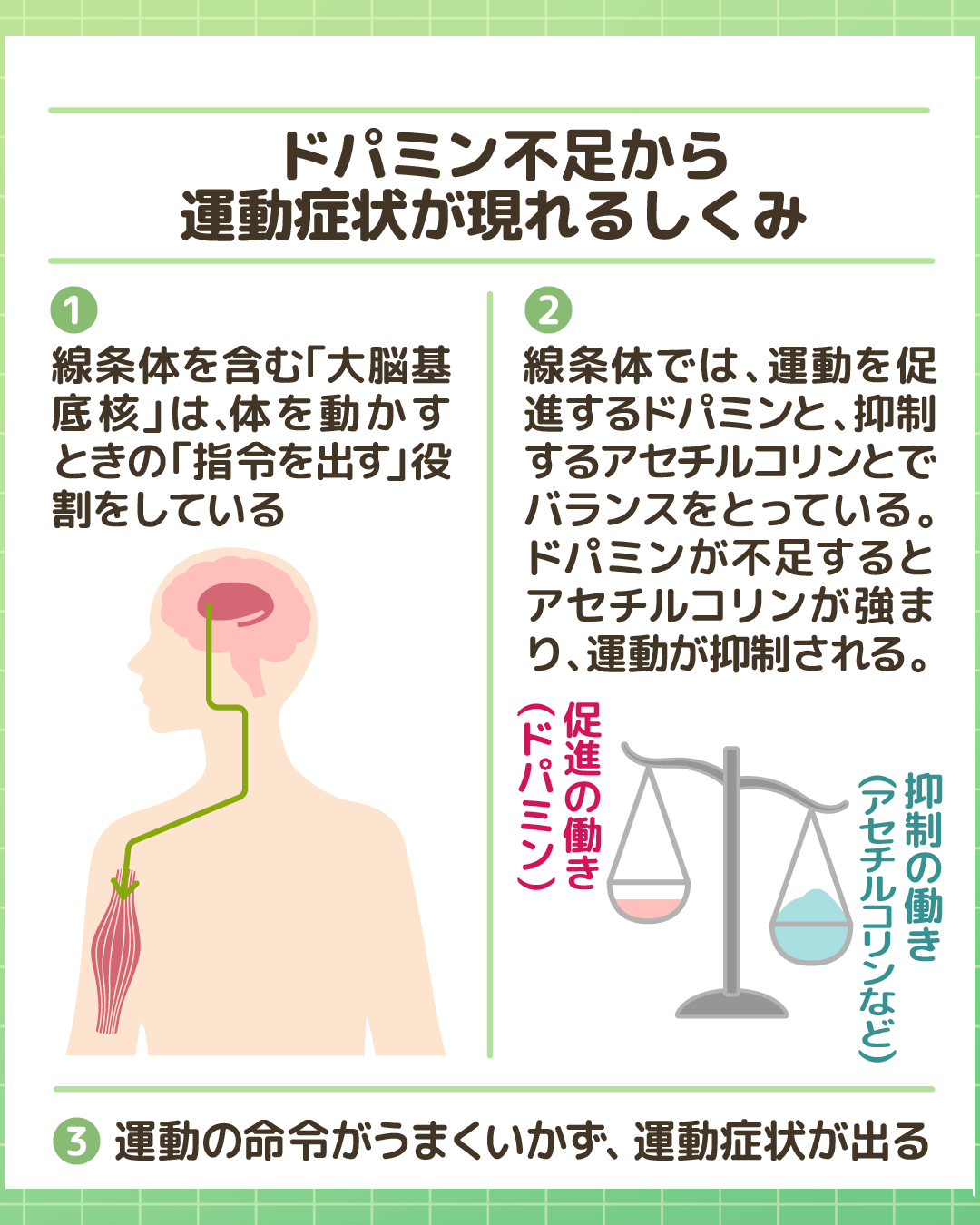 ドパミン不足で運動症状が現れるしくみの図。大脳基底核の役割と、運動を促進するドパミンと抑制するアセチルコリンのバランスが崩れることで運動の命令がうまくいかなくなる流れを図解している。