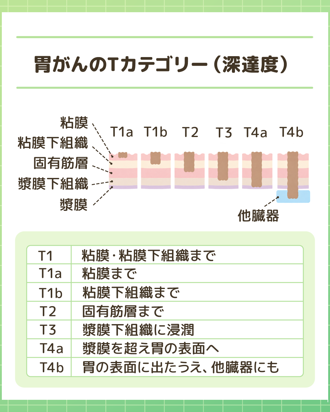 胃がんのTカテゴリー（深達度）。粘膜から漿膜、他臓器に及ぶ浸潤の深さに応じた分類（T1a、T1b、T2、T3、T4a、T4b）と各状態のイラスト・説明