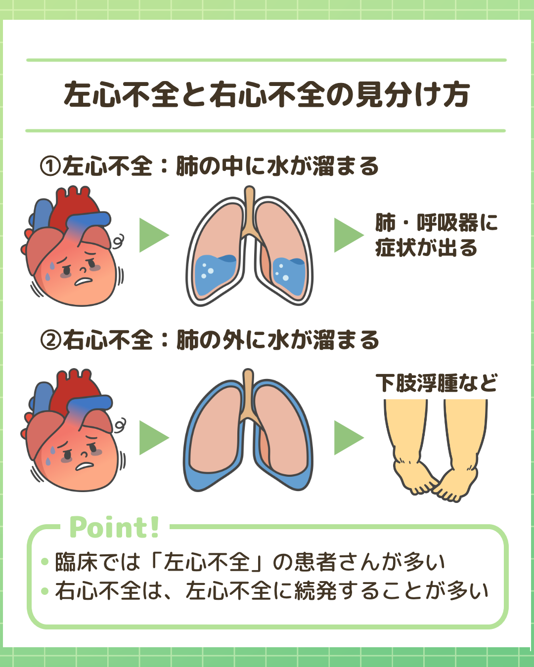 左心不全と右心不全の見分け方と症状の違いをまとめたイラスト